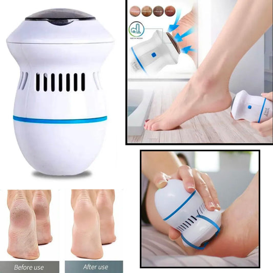 Callus Remover